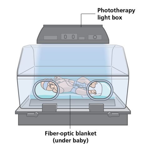 Phototherapy: Light box and fiber-optic blanket