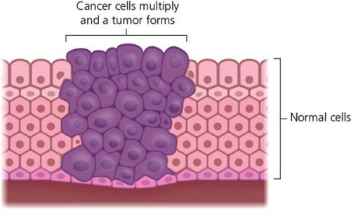 Non-Small Cell Lung Cancer: Genes, Oncogenes, Driver Mutations and ...